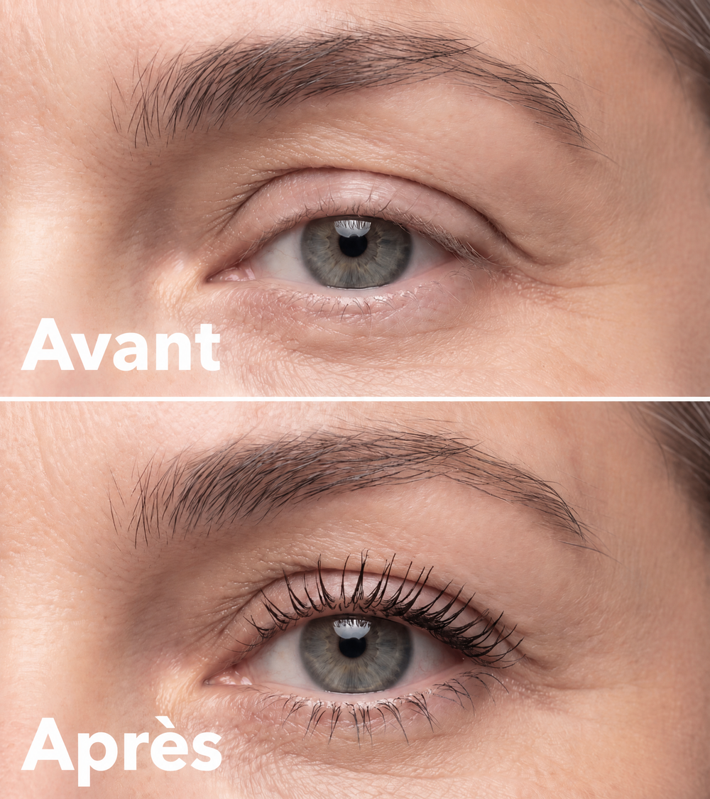 Avant, après
