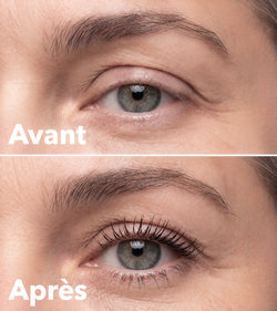 Avant, après